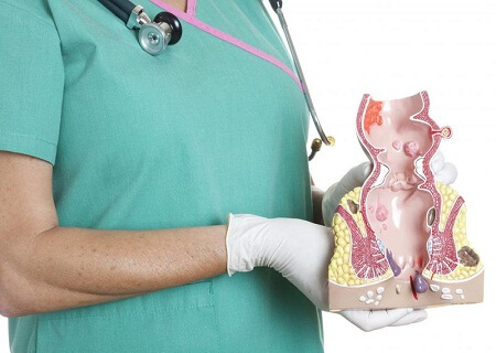 Chữa đại tiện ra máu ở phòng khám Kinh Đô