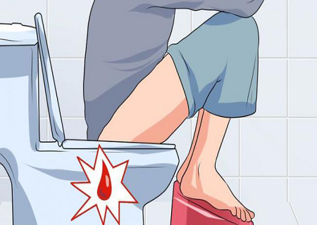 Điều trị đau nhói ở hậu môn tại phòng khám Kinh Đô