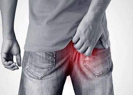 Dụng cụ nong hậu môn