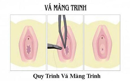 va-mang-trinh-bao-nhieu-tien